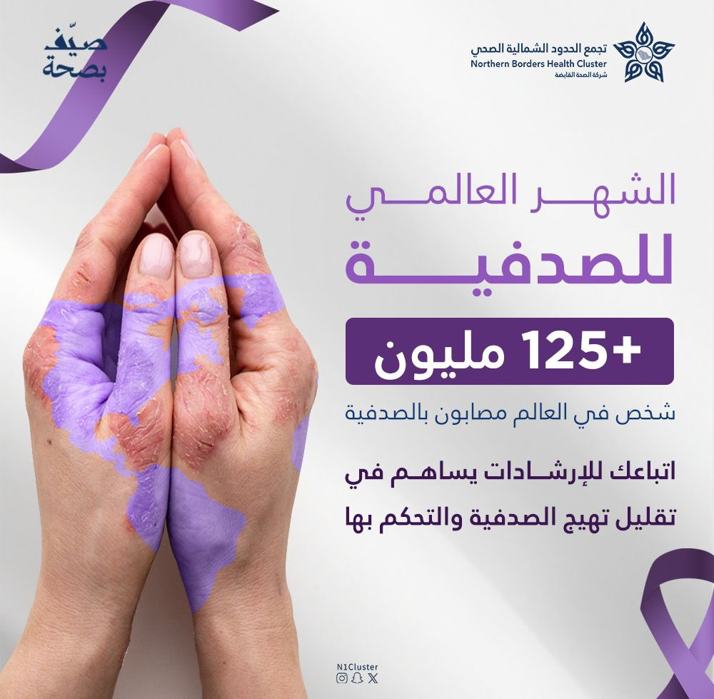 صورة مرفوعة