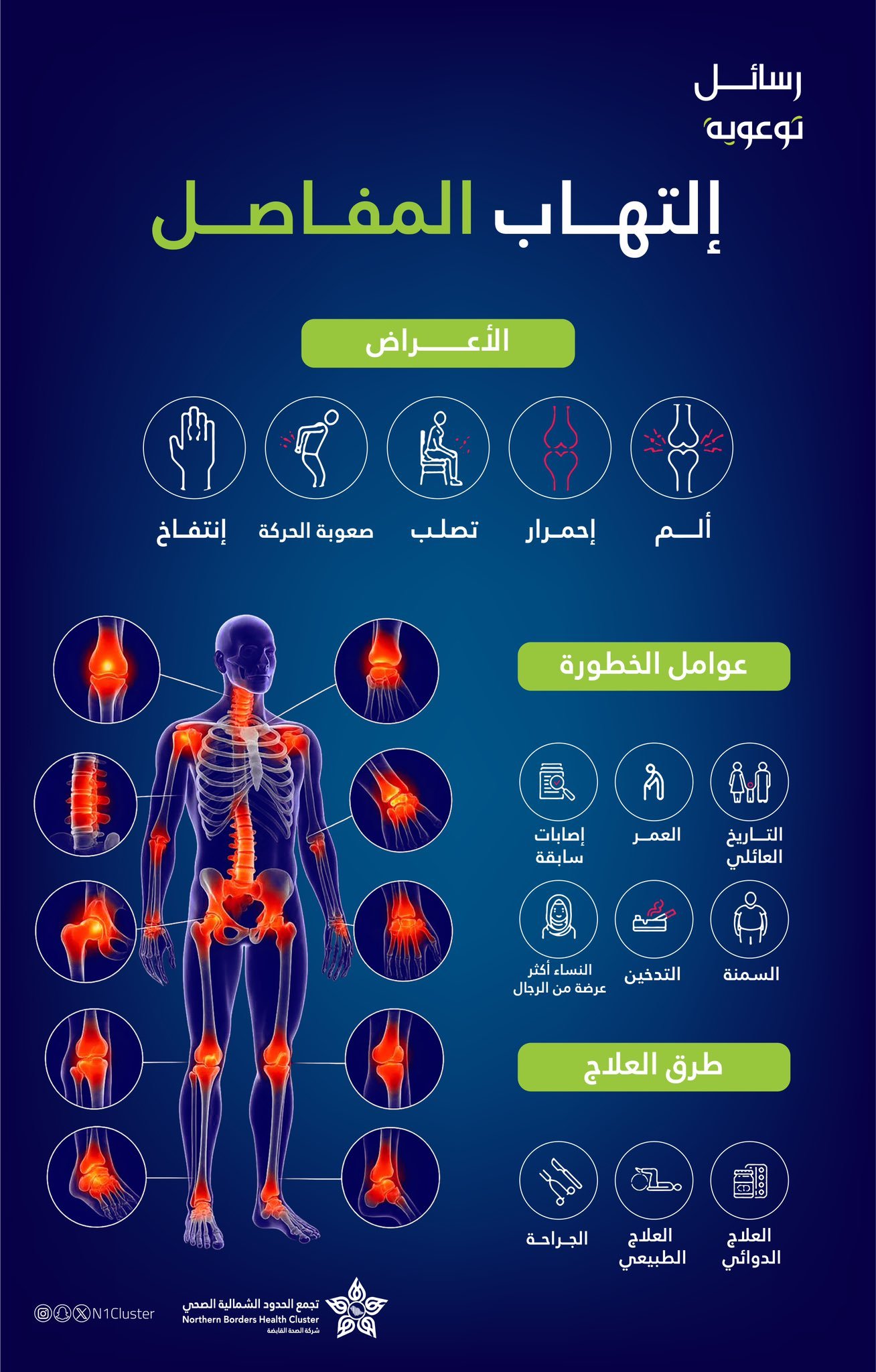 صورة مرفوعة
